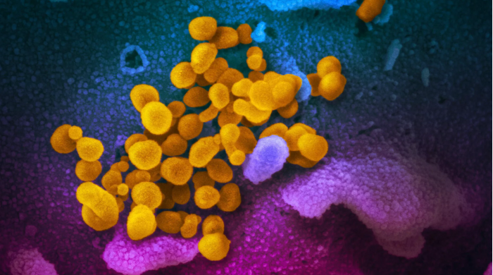 美NIAID公布新型冠狀病毒最新彩色顯微鏡圖像