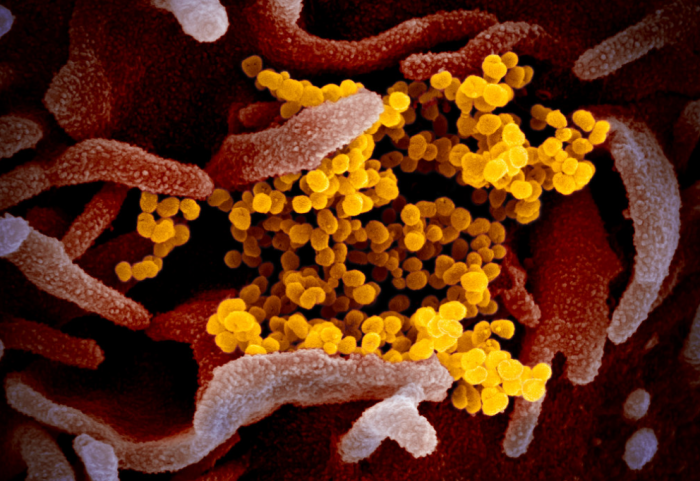 美NIAID公布新型冠狀病毒最新彩色顯微鏡圖像