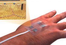 研究人員設計出用於治癒傷口的新型無線智能繃帶