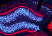 靶向光敏感蛋白質和分子的深度腦電刺激可預防小鼠模型中的癲癇發作