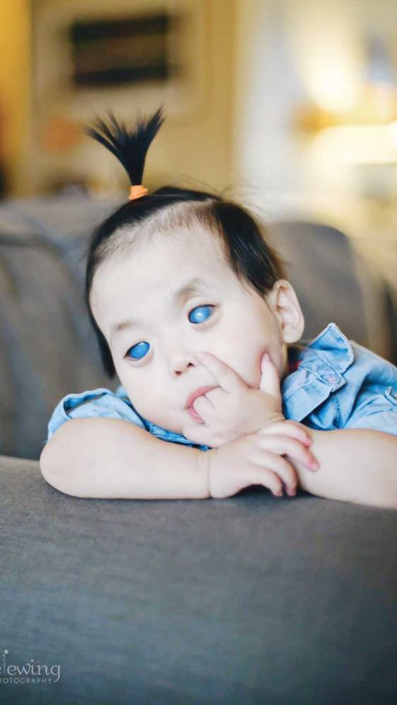 「藍眼睛女嬰」太特別沒人敢要　這對夫妻不顧反對帶回家：我們不後悔