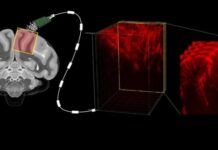 用超聲波「讀心」：加州理工學院科學家展示新型腦機接口技術