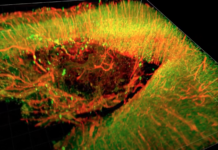 研究人員利用一種「腦膠」材料實現神經元創傷後再生