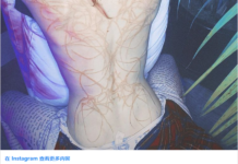 全球首富馬斯克女友曬後背紋身：「外星疤痕」感受下