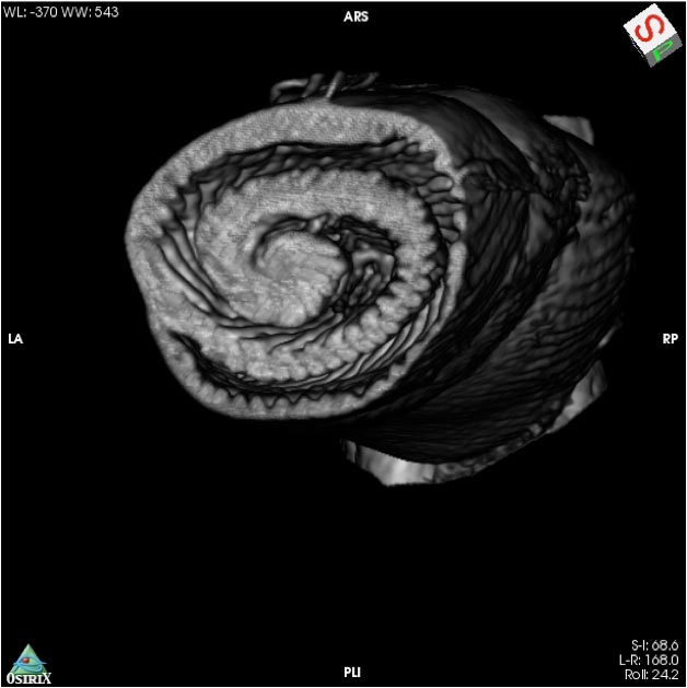 無需解剖：研究人員創建出鯊魚腸道高解析度3D圖像